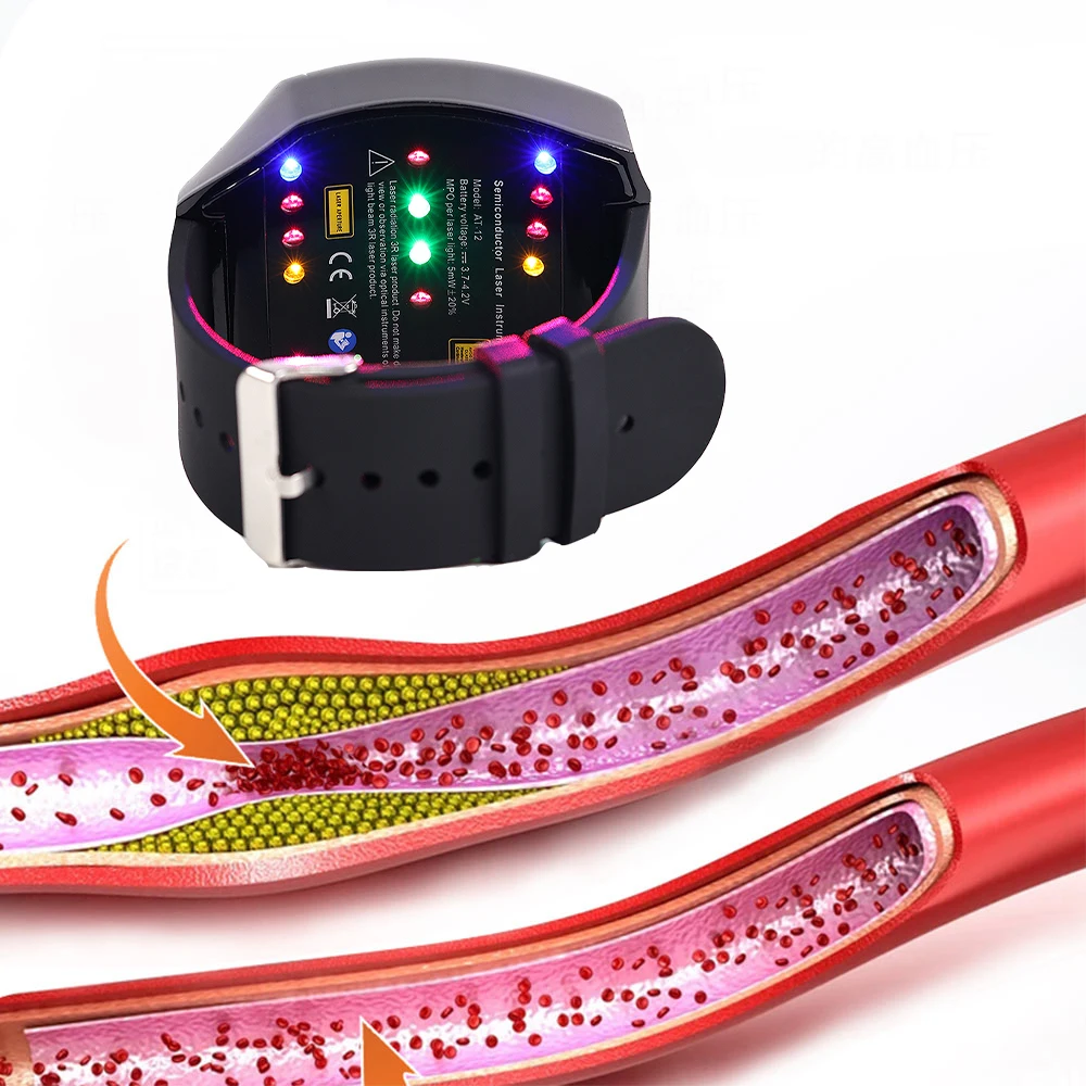 Advanced Laser Therapy Watch for Health Management